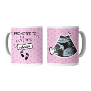 Custom Ultrasound Photo Mug - Image 5