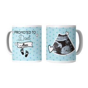 Custom Ultrasound Photo Mug - Image 6